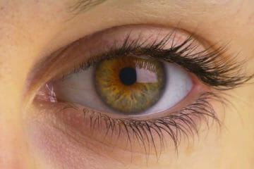 Common Vision Problems